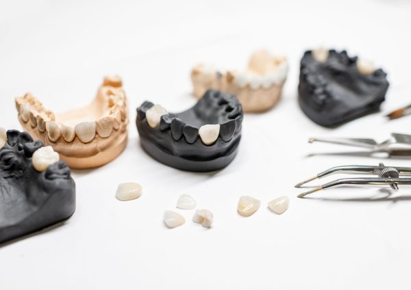 artificial-jaw-models-with-veneers-2025-03-14-12-10-33-utc